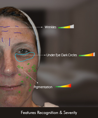 Skin Rigor MySkinMirror